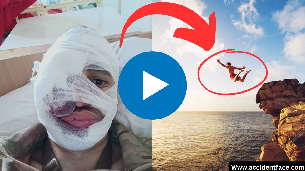 Split Face Diving Accident Mishap: Cautionary Tale ALERT!